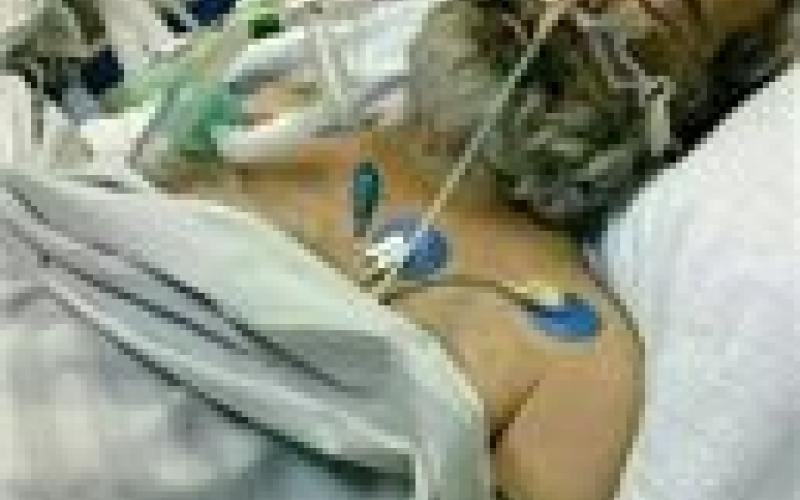 استشهاد أسير مقدسي متأثرا بجروحه