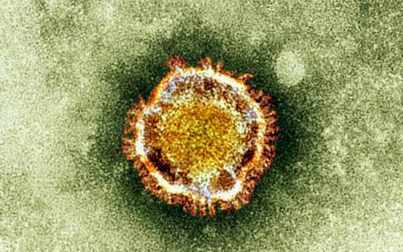 الصحة: التأخر في علاج الكورونا يزيد احتمالية الوفاة  