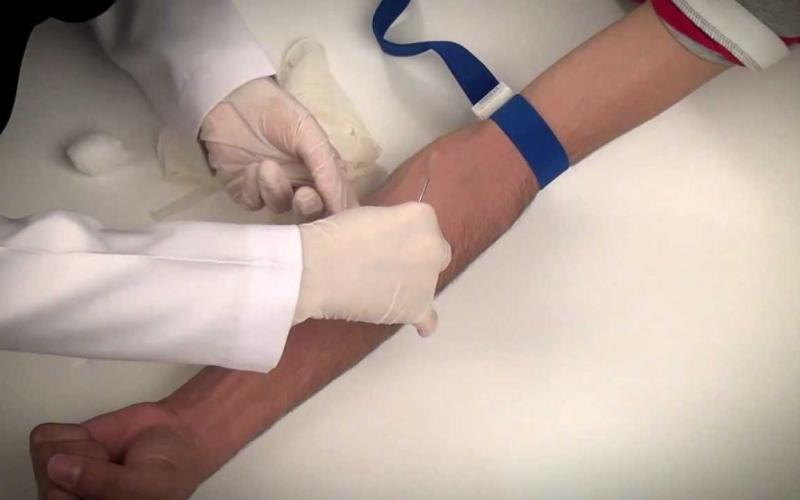 180 إصابة بمرض الكبد الوبائي" ب" سنويا في الزرقاء