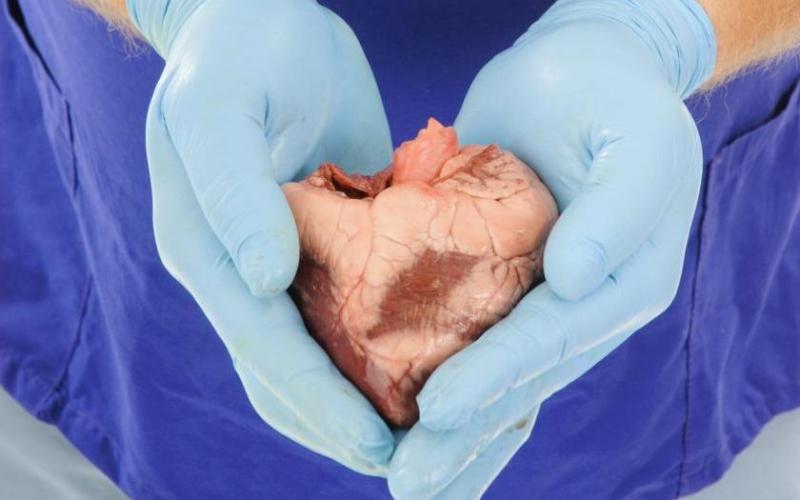 التبرع بالأعضاء.. "ومن أحياها فكأنما أحيا الناس جميعا"