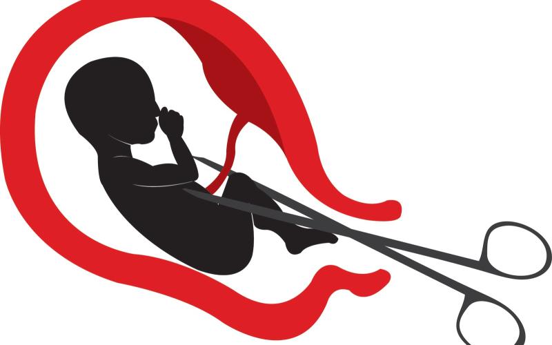 "اجهاض العيادات" يعرض ضحاياه لخطر الموت