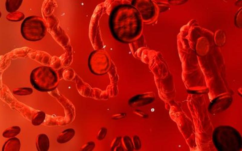 معاناة مرضى اللاشمانيا من اللاجئين السوريين في الأردن