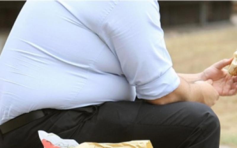  12 الف عملية جراحة سمنة سنويا في الأردن