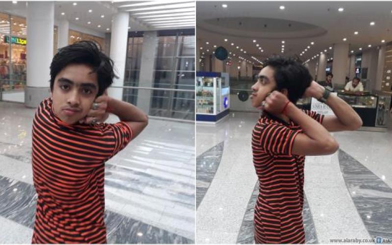 فتى يستطيع تدوير رأسه 180 درجة