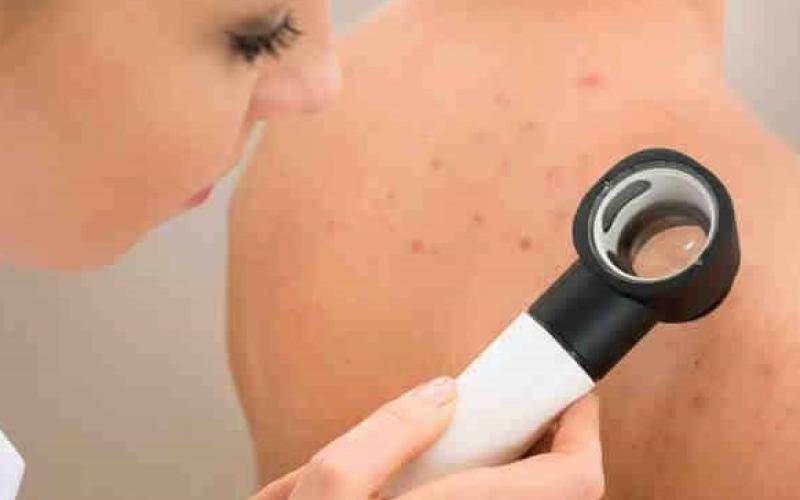 اكاديمية اردنية تكتشف مرضا جلديا نادرا